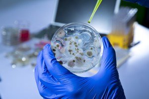 Cultured Microbes in Petri Dish
