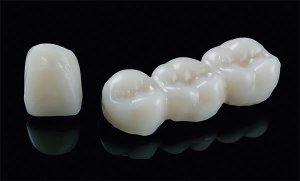 dientes-temporales